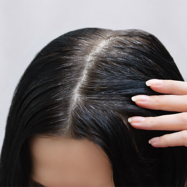 home remedies for gray hair